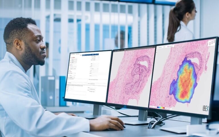Une technologie d'IA israélienne pour aider les pathologistes à détecter le cancer gastro-intestinal