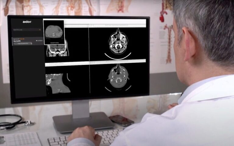 L'Israélien Aidoc lève 66 millions de dollars pour la technologie de l'IA afin d'aider les radiologues à lire les scans