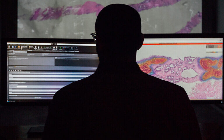 La société suisse de diagnostic Unilabs utilisera la technologie de détection du cancer Ibex dans les laboratoires