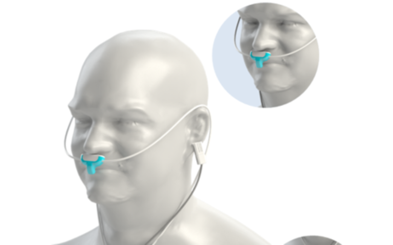 La start-up médicale NanoVation obtient le soutien de l'UE pour un moniteur respiratoire