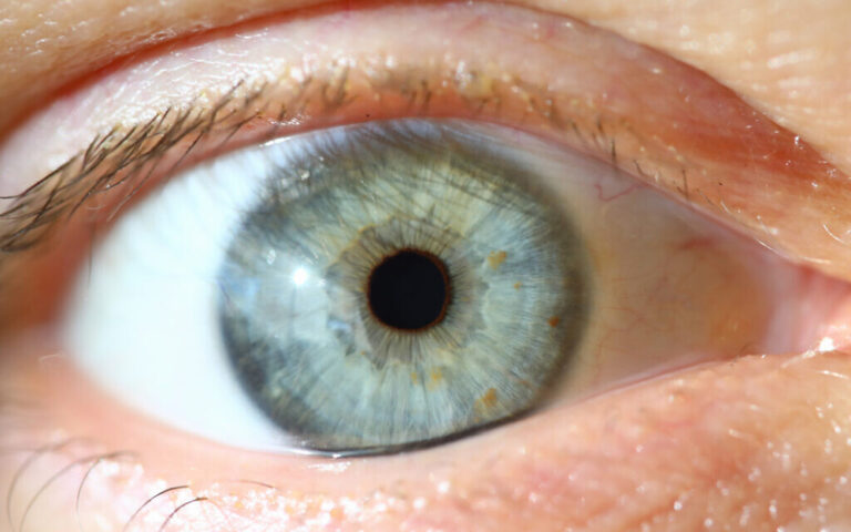 Des médecins israéliens identifient et résolvent un problème post-vaccin pour les cornées transplantées