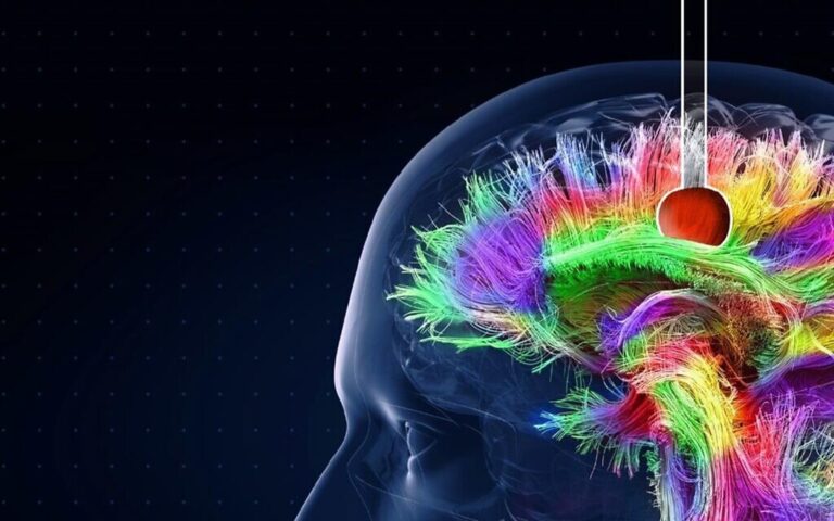 Les robots de précision d'une startup israélienne prêts à transformer la chirurgie du cerveau