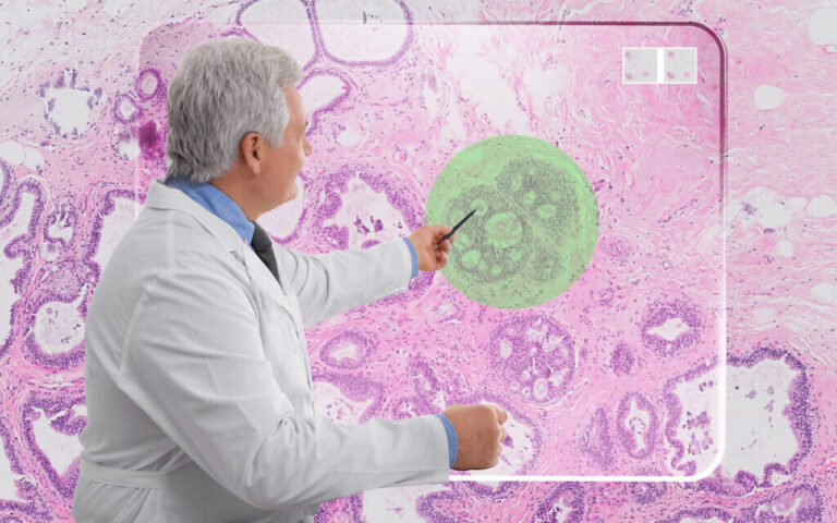 La technologie israélienne pour aider les pathologistes à détecter le cancer obtient le feu vert de la « percée » de la FDA