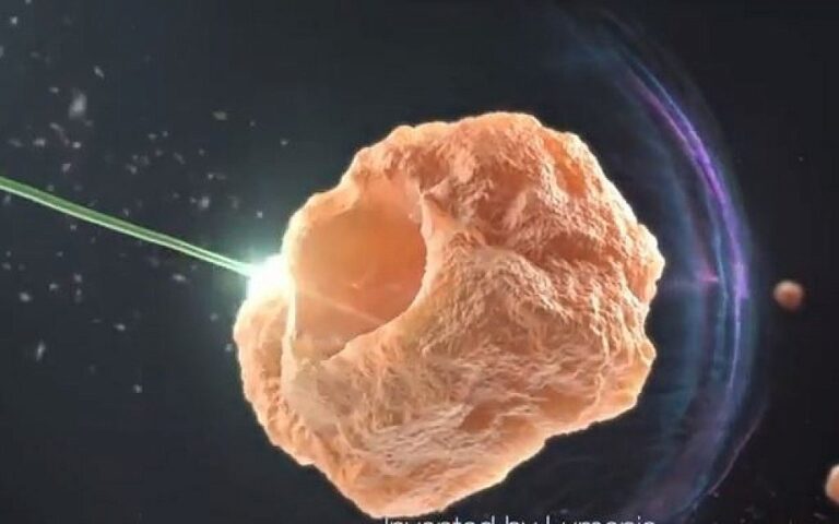 Lumenis vend ses activités chirurgicales à la société américaine Boston Scientific pour 1,1 milliard de dollars