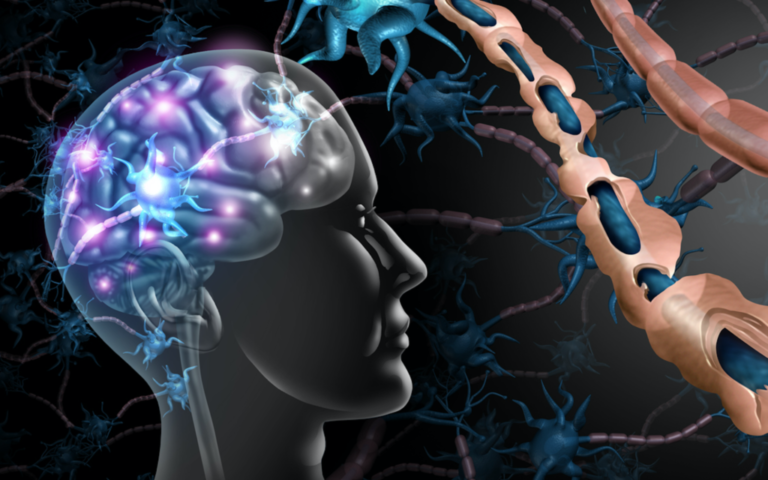 Le traitement par cellules souches « gèle » la SEP et permet à certains de remarcher, selon une étude de Jérusalem