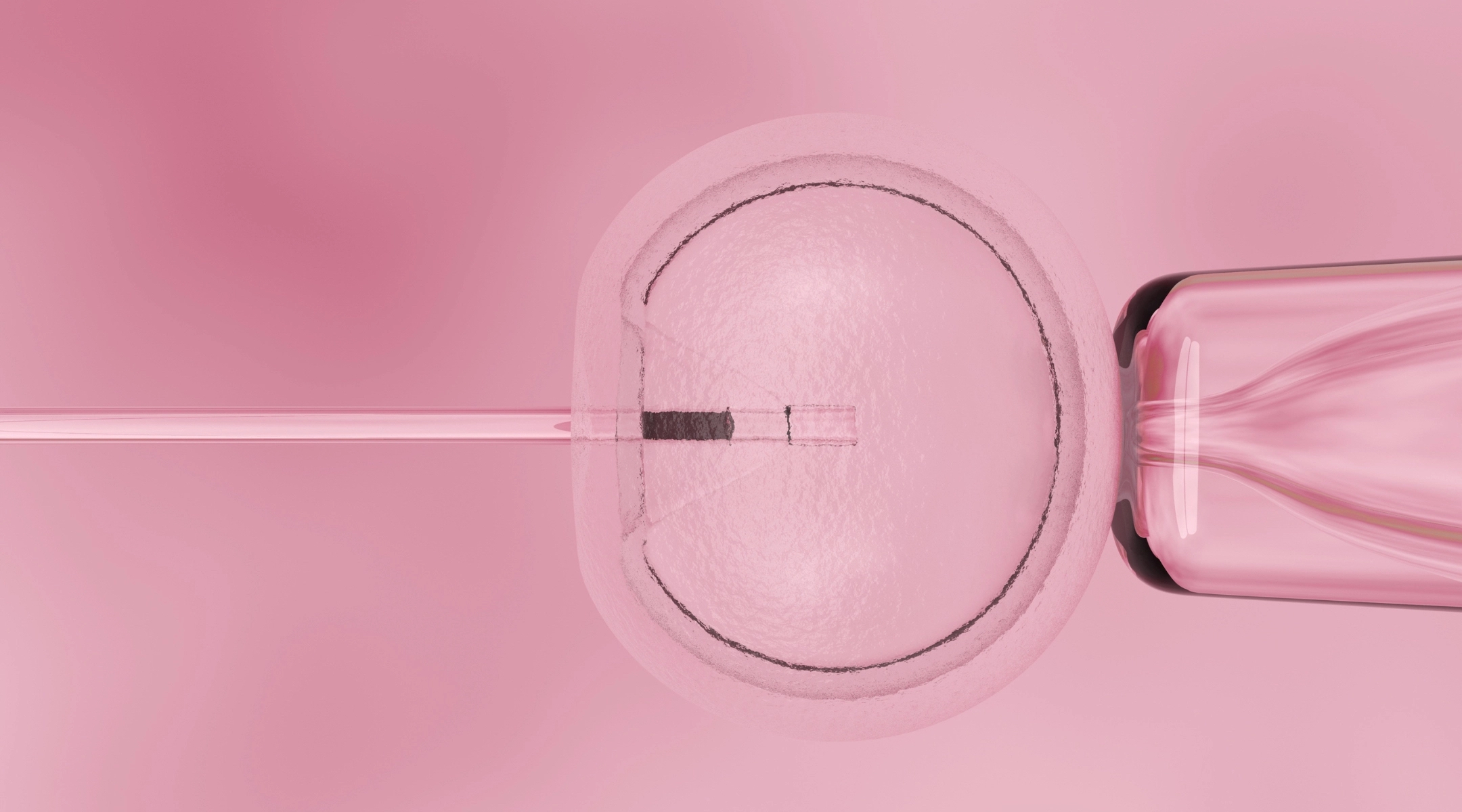 Un juge du Kentucky rejette le procès intenté par des mères juives qui contestaient l'interdiction de l'avortement dans l'État