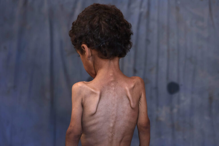 Gaza est affamée. Où sont les dirigeants juifs américains?